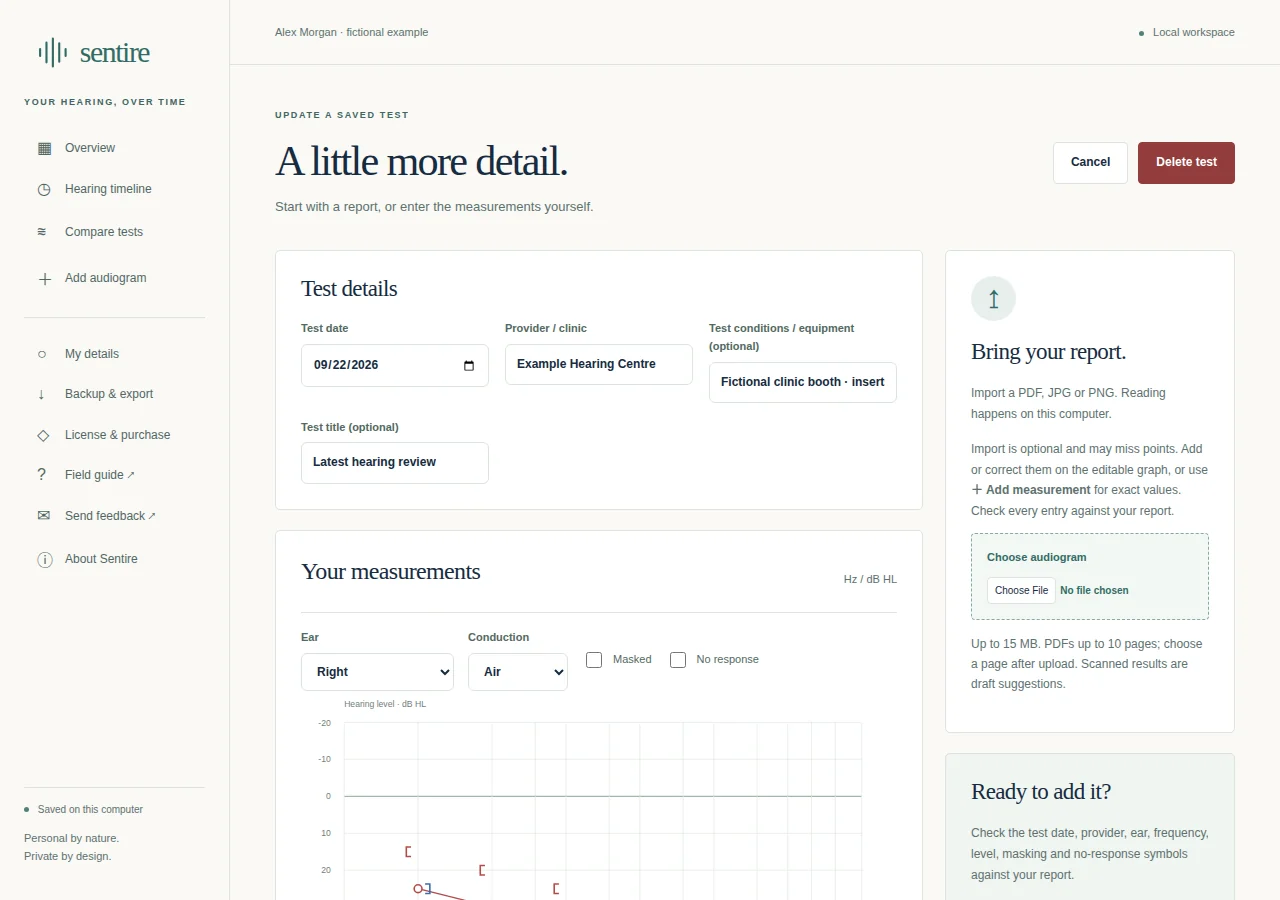 Sentire’s manual audiogram editor with chart, plotting options and numeric measurement table.