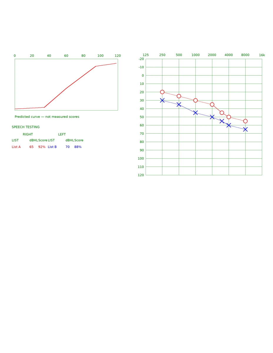 A generated fictional report with a threshold grid and measured speech-score table.